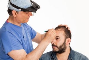 Hair transplant history