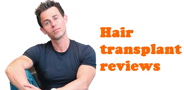 Hair transplant reviews