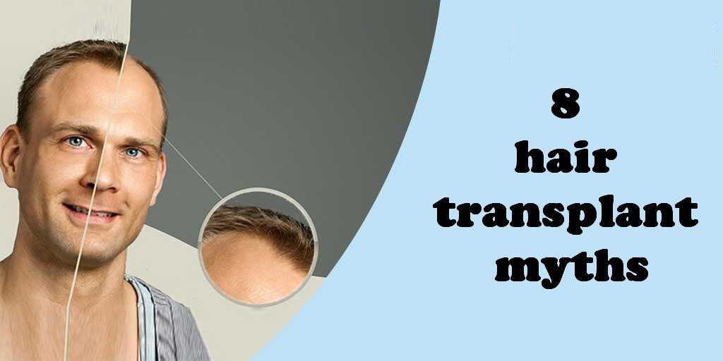 8 hair transplant myths